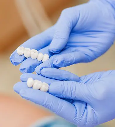 Dental Crowns & Bridges Greensborough