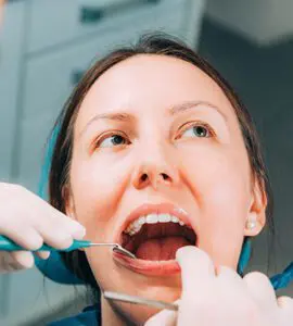 Fissure Sealants Greensborough