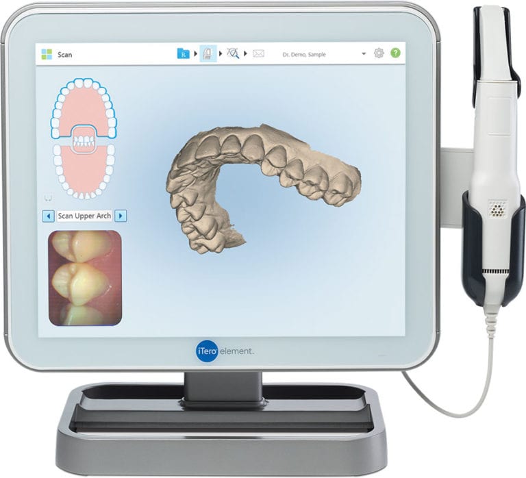 iTero 3D Scanner 3D Dental Scans Banyule Dental Greensborough