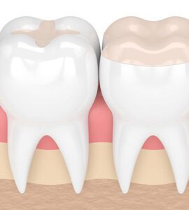 Restorative dentistry BDental