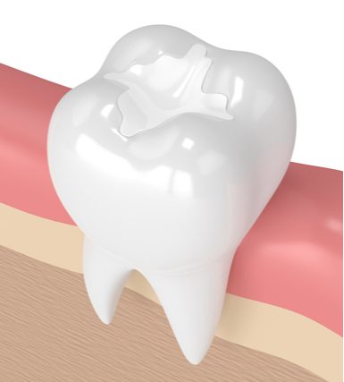 Restorative dentistry