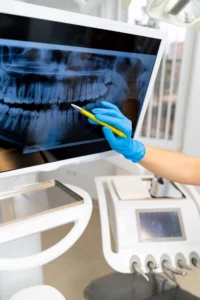 The dentist at Banyule Dental explaining the X-ray result